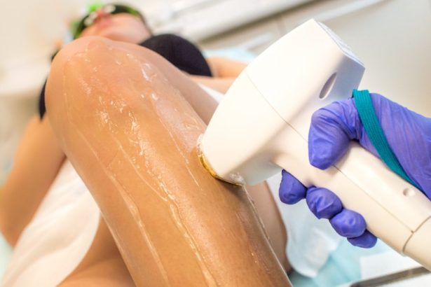 Centres d’épilation laser à Paris et en IDF : comment choisir ?